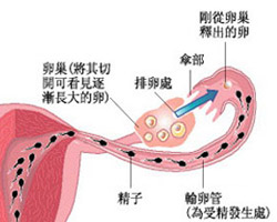 沈阳京科医院 输卵管堵塞症状图片